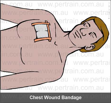 Bandage chest wound