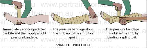 Snake bite procedure