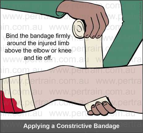 Constrictive bandage