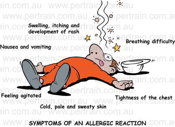 Symptoms of an allergic reaction