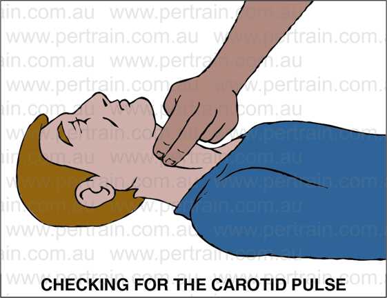 Carotid