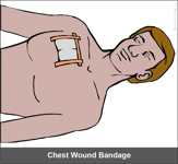 Bandage chest wound