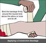Constrictive bandage