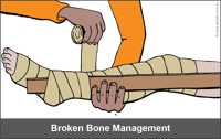 Broken bone management